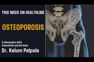 Osteoporosis: Risk factors, nutrition requirement, and treatment modalities - Healthline - Epi - 34